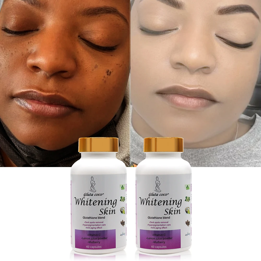 Gluta Pills Brightening Skincare Remove Dark Spots Blemish Tablets Collagen  Capsule Skin Whitening for Black Skin