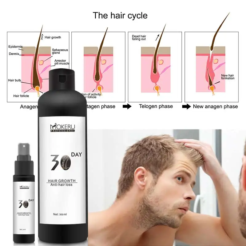 Какое средство помогает от выпадения волос для мужчин
