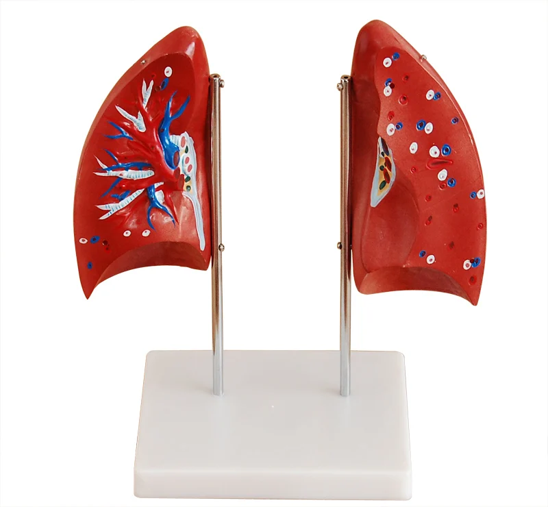 Medical Teaching Used PVC Simulation Human Anatomy Lung Respiratory System Structure Model