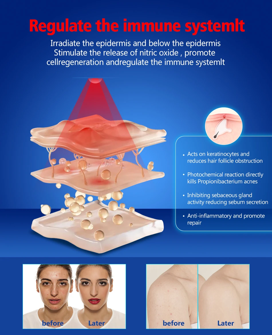 OEM Med Spa Whole Body Contouring 635nm 660nm 810nm 850nm Red Light Capsule Infrared LED Red Light Therapy Bed