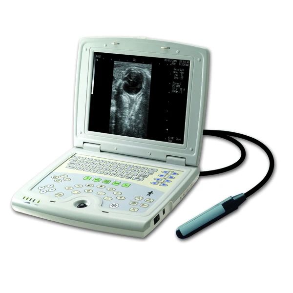 medical equipment laptop full digital b/w ultrasound scanner