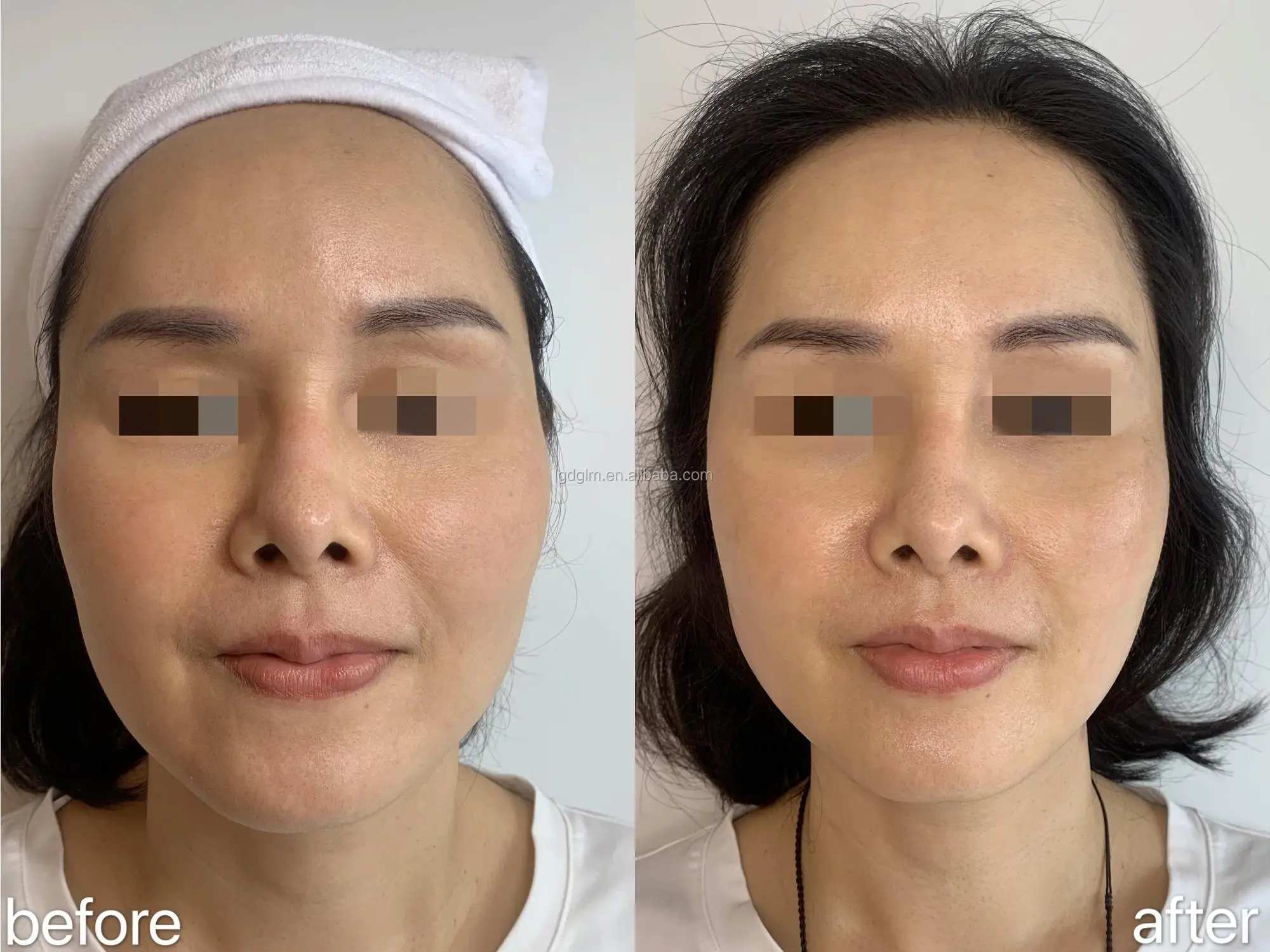 before and after 4