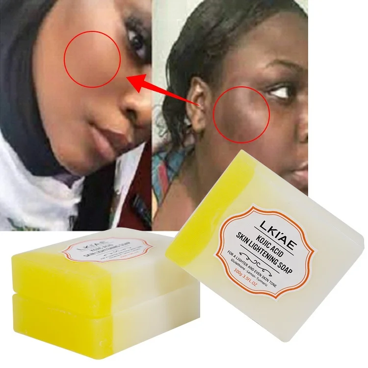 glutathione soap for melasma & Dark Spot Skin Care  Hyperpigmentation Solutions Get ready to say goodbye to melasma and hello to your best skin yet Precious Skin Gold 24K Collagen