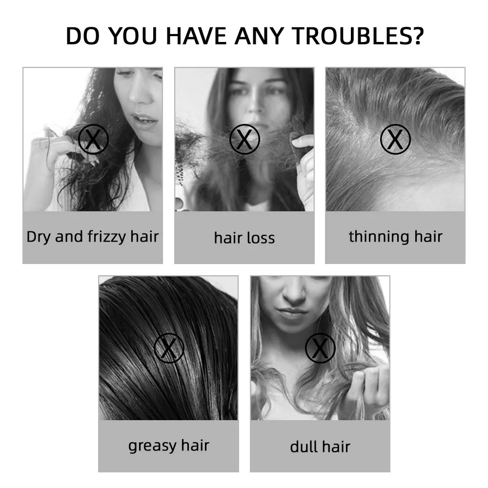 Custom High Quality Natural Rosemary Hair Care Essential Oil For Hair