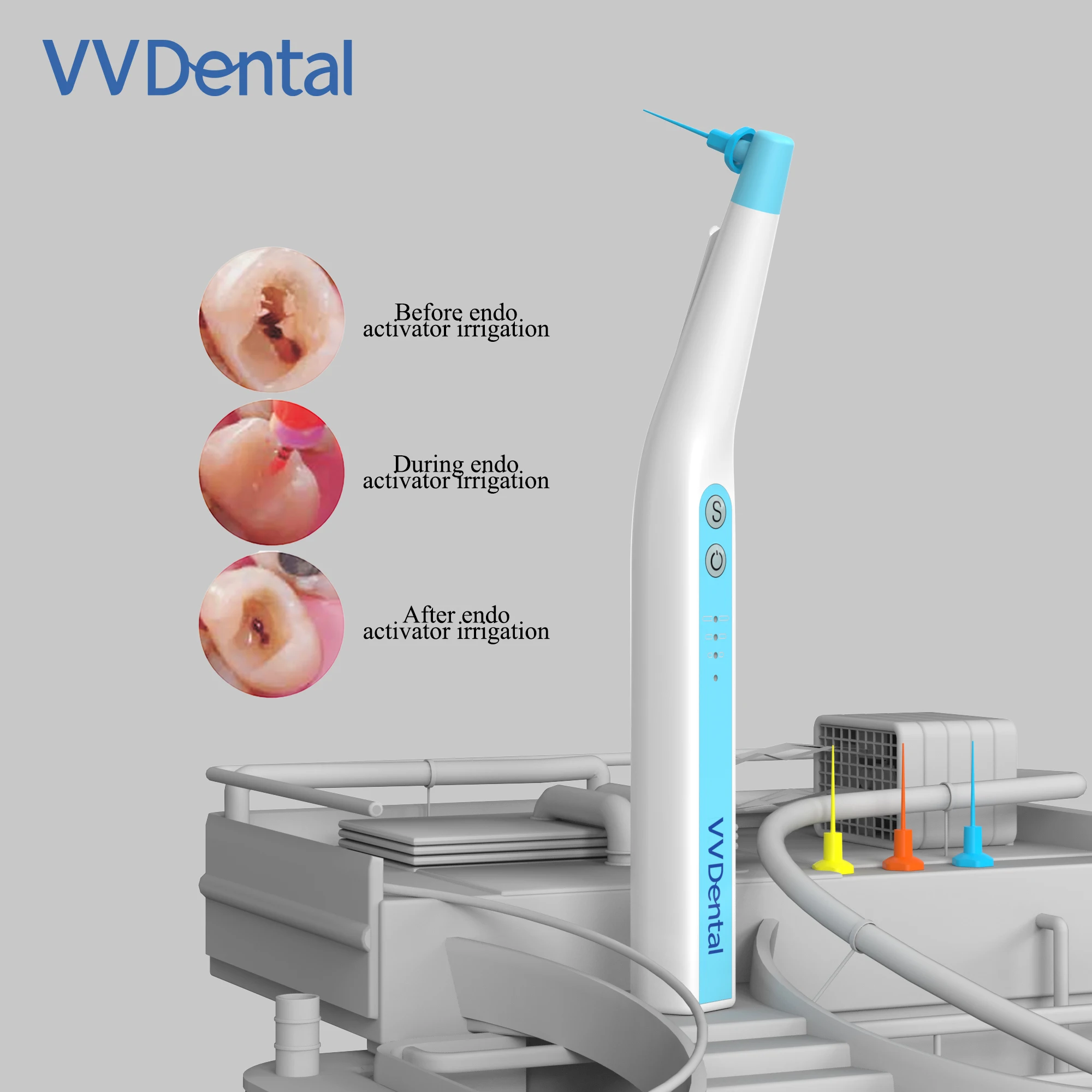 DENTAL ENDODONTISCHER ULTRAAKTIVATOR Ultraschall Endo Spülung DENTAL ENDODONTISCHER ULTRAAKTIVATOR Ultraschall Endo Spülung
