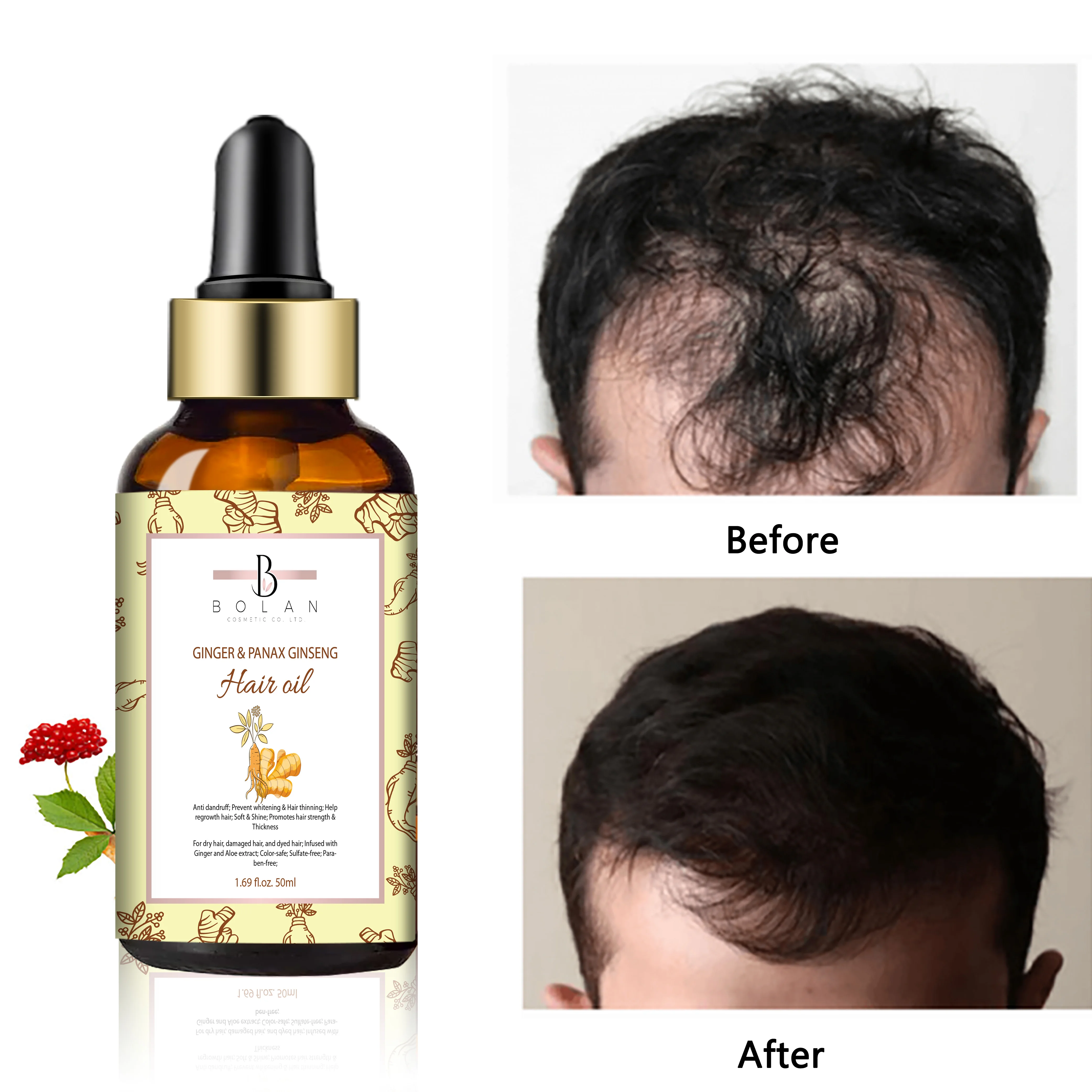Best Chinese Regrowth Repair Hair Products Hair Growth Oil For Kids - Buy  Hair Loss Product,Hair Growth Syrum,Fast Hair Growth Oil Product on  Alibaba.com