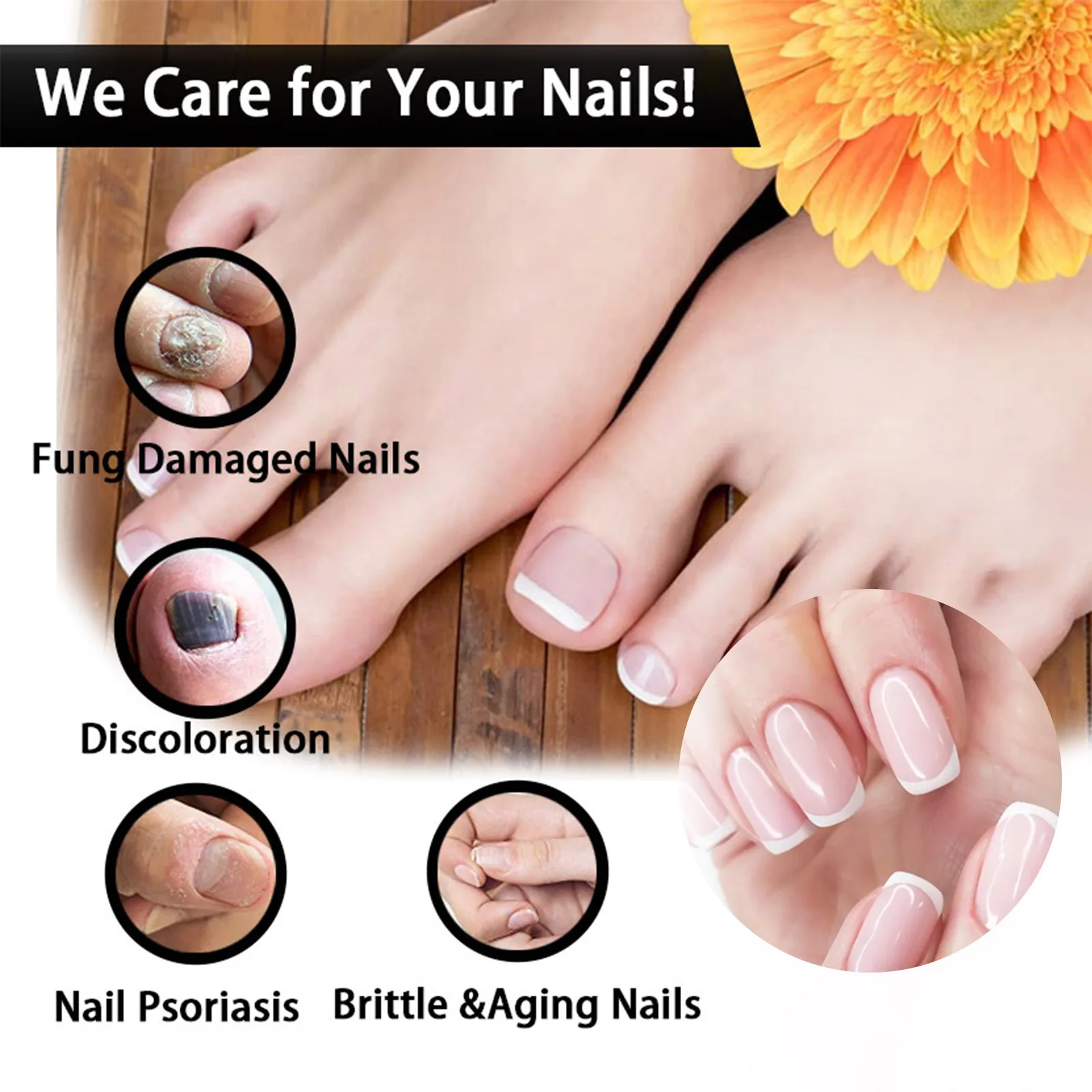 EELHOE Wholesale 30ML Nail Repair Liquid Thickening Brightening Repairing Serum Nail Fungal Nail Care Liquid