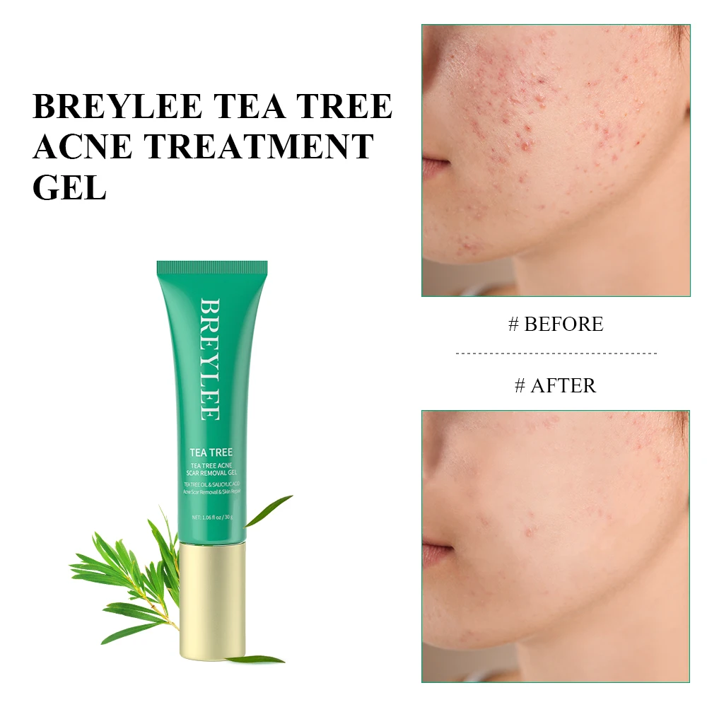 BREYLEE Advanced Formula Acne Mark Scar Soothing Gel Remova