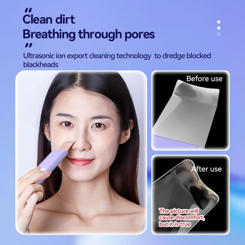 Высокочастотный скребок для лица, многофункциональный инструмент для ухода за кожей, скребок для кожи лица