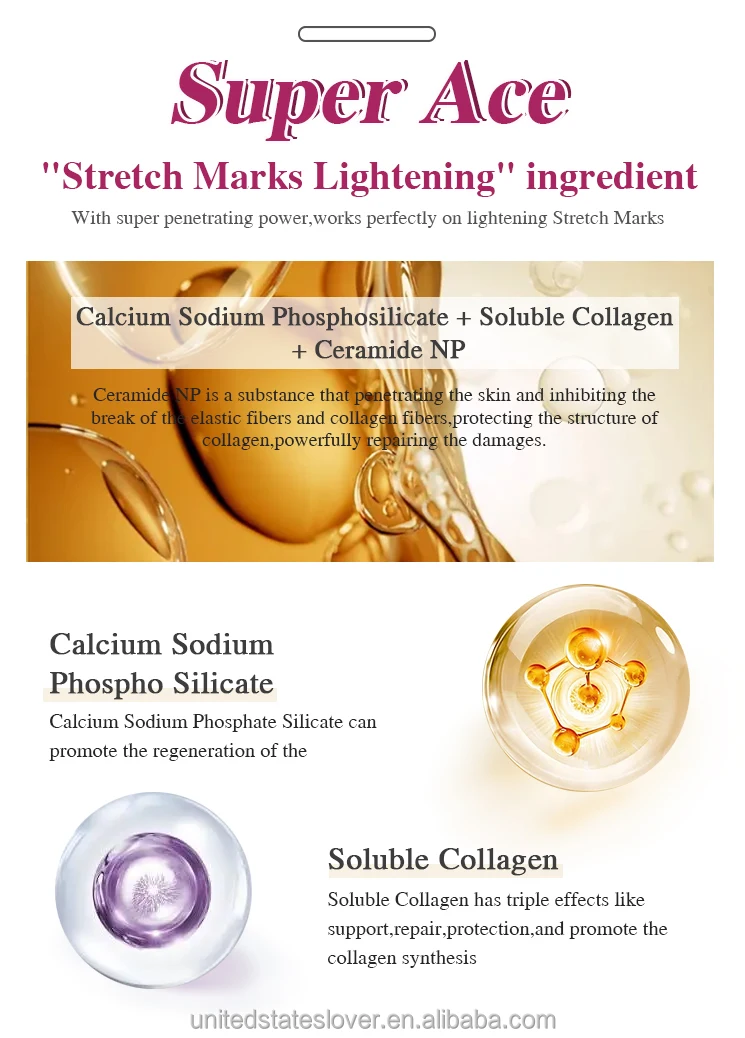 Black Skin Stretch Marks Reducer Skincare Cream Collagen Treatment