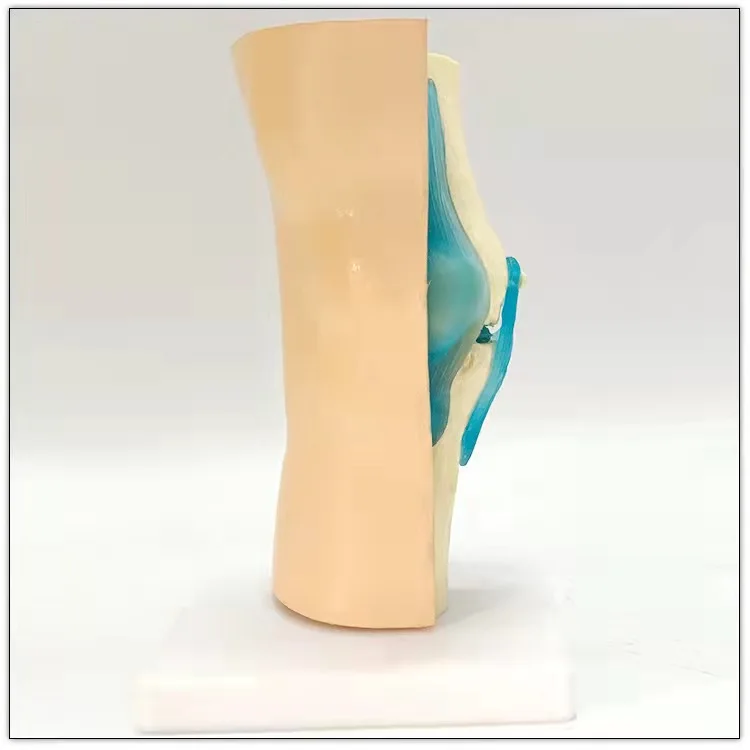 Разборная модель медицинской конструкции для анатомии и связки коленной кости человека