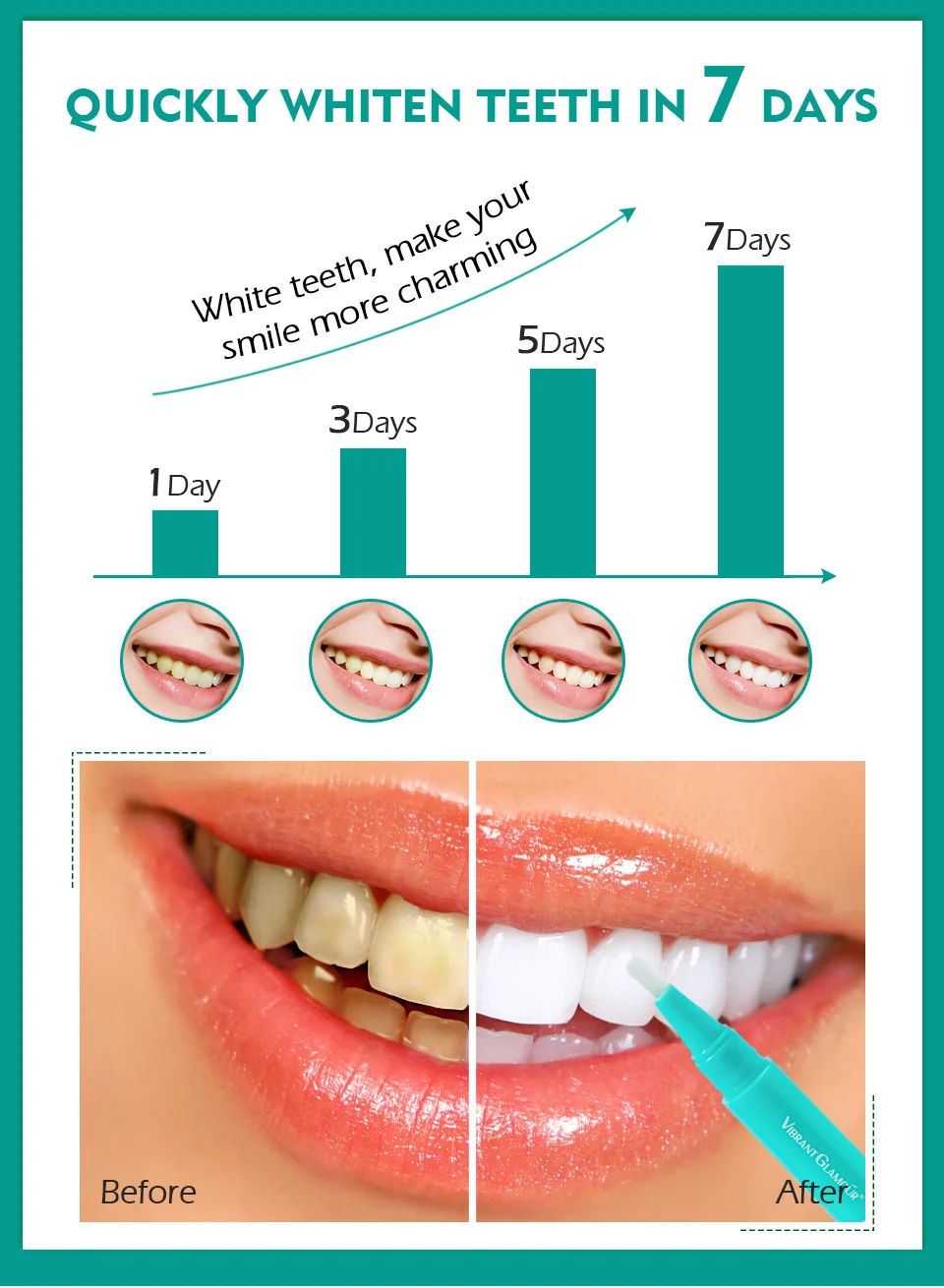 Wholesale VIBRANT GLAMOUR Tooth Whitening Gel Dental Teeth Whitening Tooth Bleaching Pen