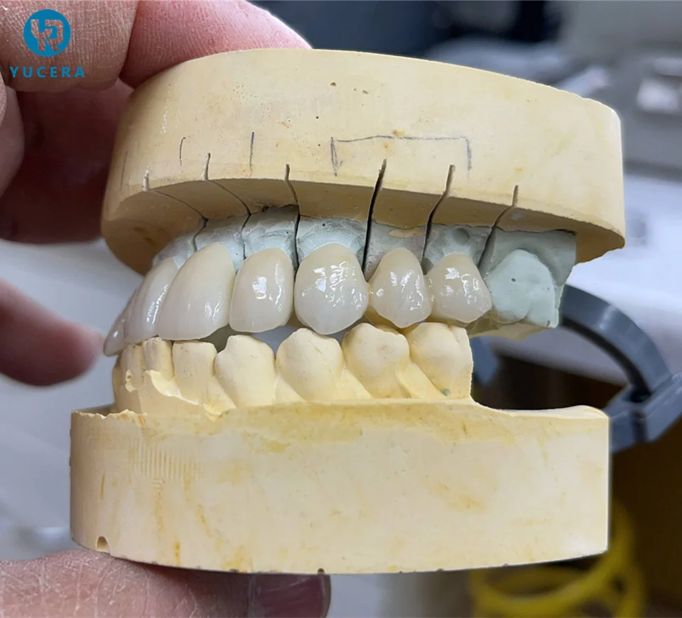 Wholesale Price Yucera SHT Multilayer Zirconia Blocks Dental Lab Zirconia Block of Denture