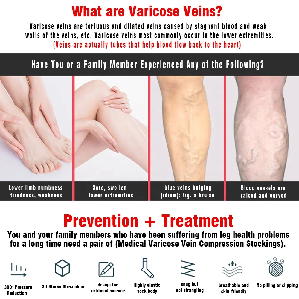 Durable Semi-transparent Compression Over Knee Stockings 15-20mmhg 20-30mmHg Open Toed for Varicose Veins