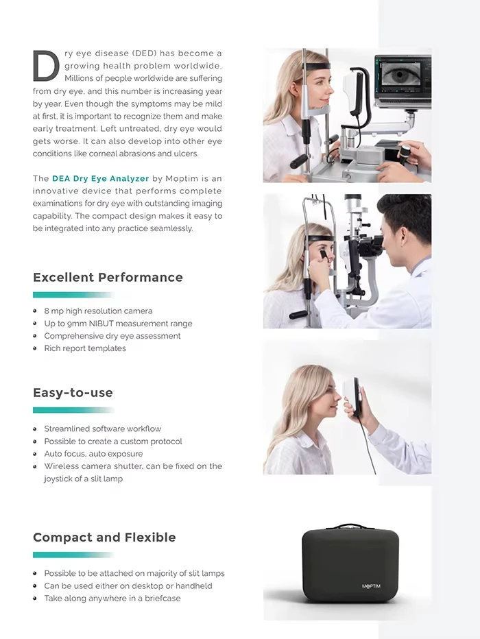 Ophthalmic Dry Eye Analyzer Dry Eye Examination Surface Analyzer Complete Dry Eye Diagnosis