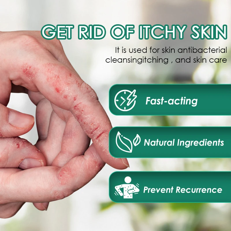 quick effective pure natural chinese herbal dermatitis pruritus psoriasis treatment cream ointment for skin problem