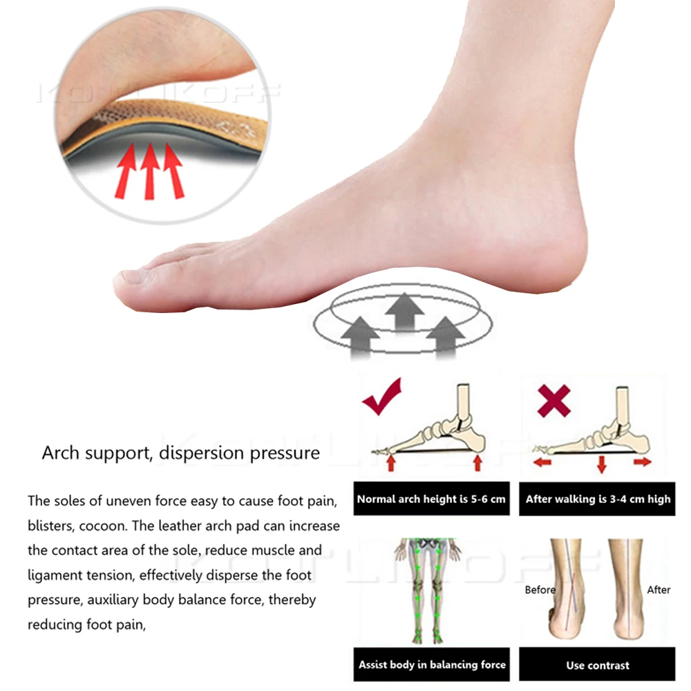 Penyebab Kaki Datar Apa Itu Flat Foot Insole Sepatu Kulit Sol