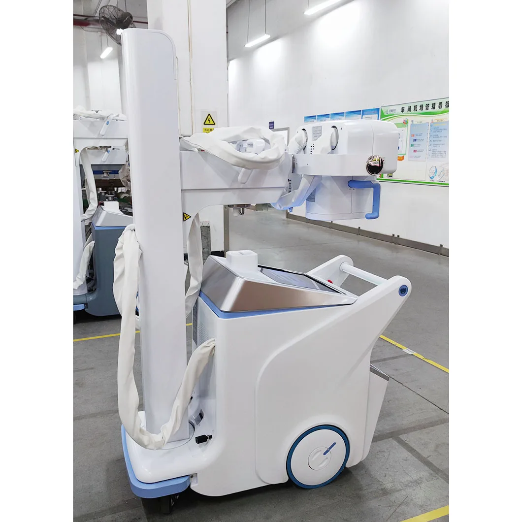 Best Price Radiography Department Medical Diagnostic Equipment X Ray Equipment Digital Mobile X-ray System