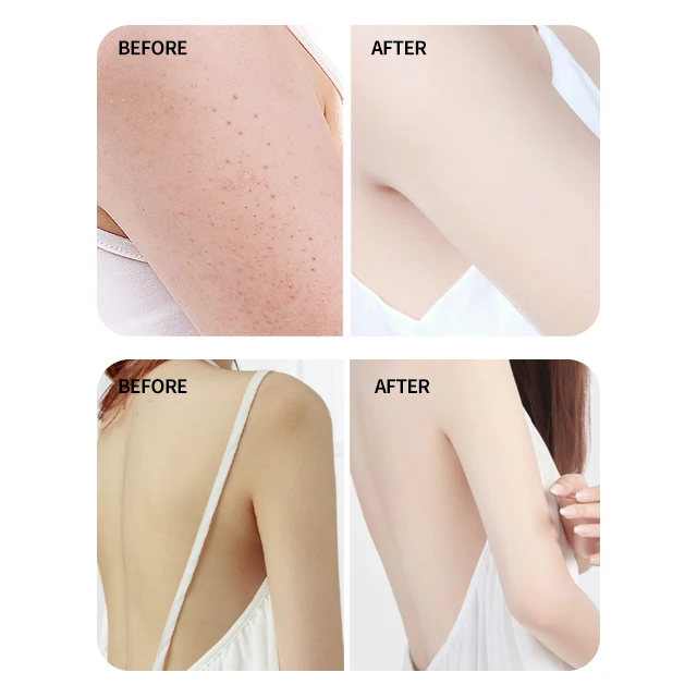 
 100% натуральный отбеливающий отшелушивающий скраб для ванны с фирменным логотипом на заказ  