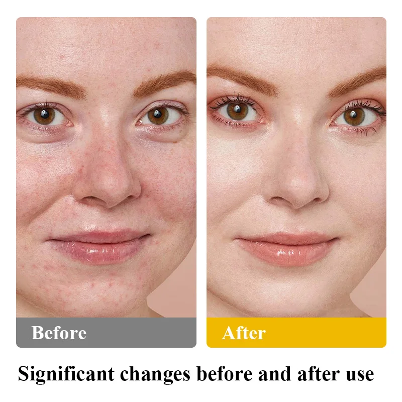 Pelle Idratata Regolarmente Di Crema Idratante. Prendersi Cura Della Sua Bella Donna Che Diffonde Sul Viso Image157394260 - Foto 6