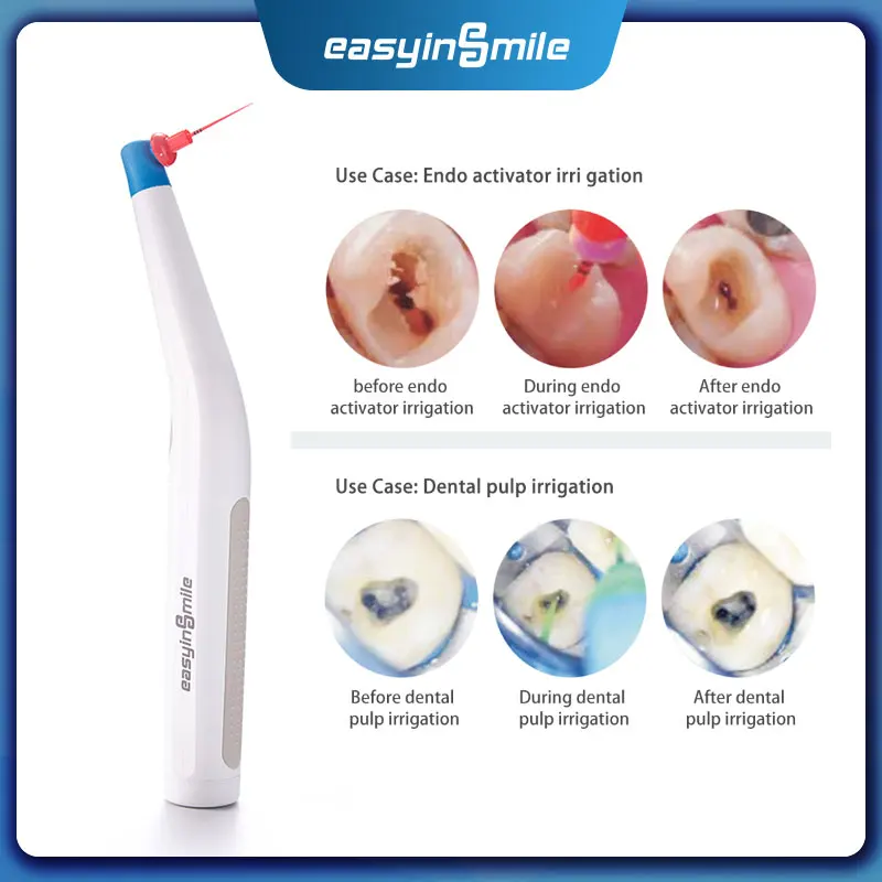 Easyinsmile Endo Activatorbasic High Efficient Endodontic Sonic