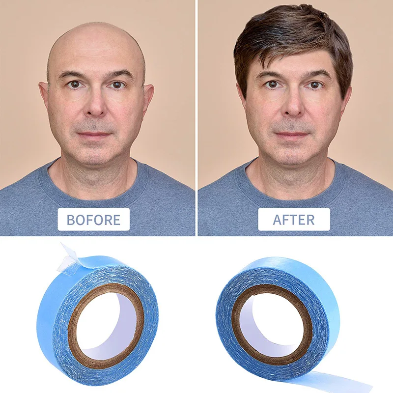 Pizzo Anteriore Aa Contorno Nastro Biadesivo Blue Liner - Foto 10