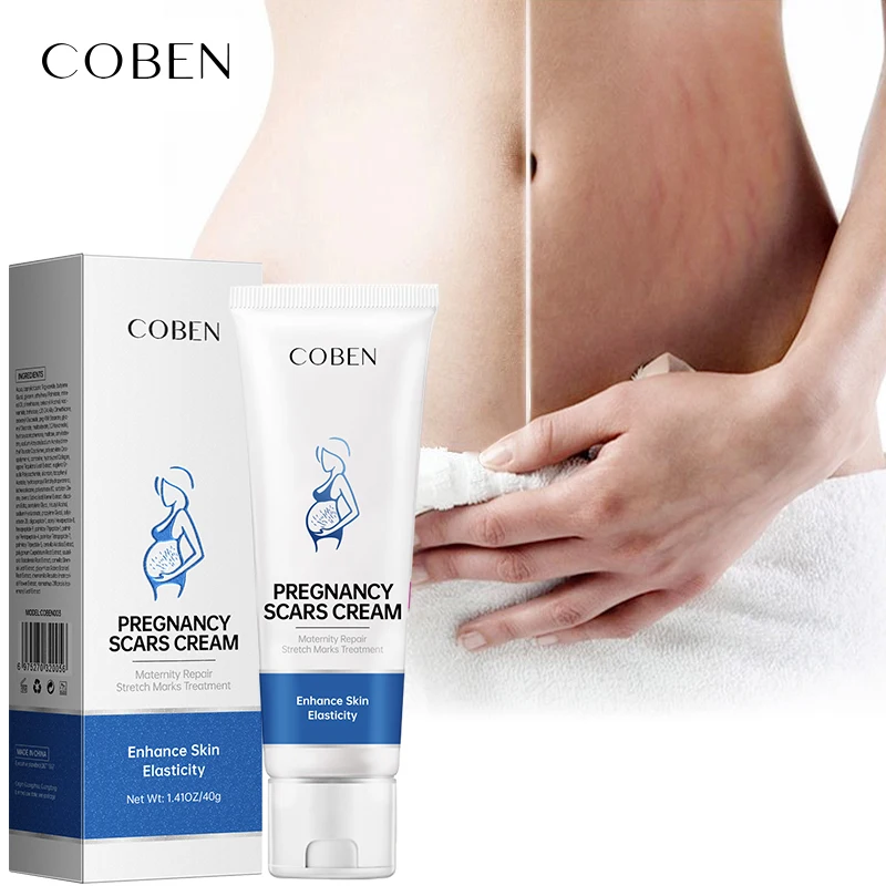 Source COBEN stretch marks removal Cream Maternity pregnancy Tummy