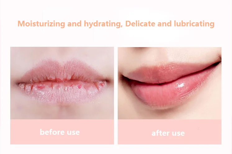 Kiss Beauty Cute Lip Oil Moisturizing Nourishing Lip Magic Clear Lip ...