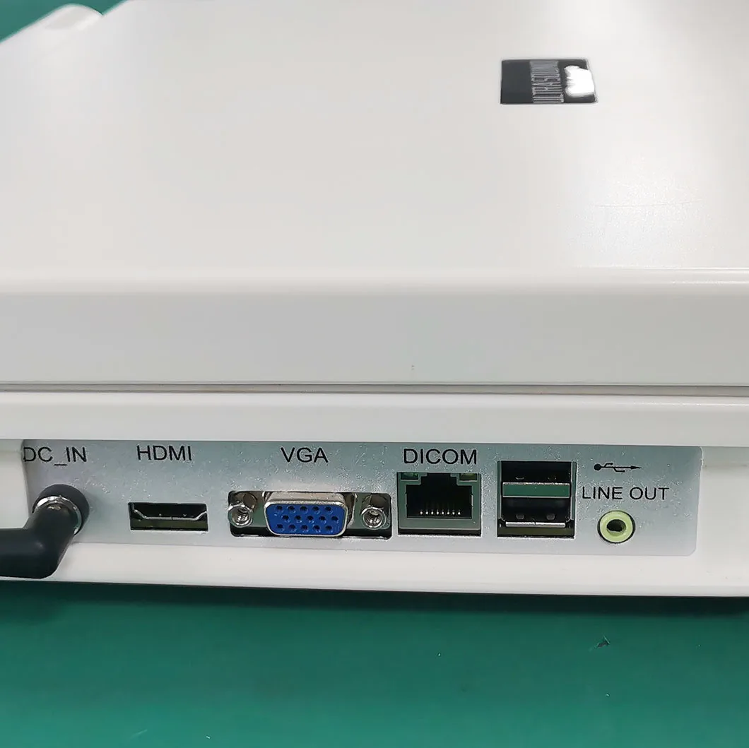 HUC-180 Full Digital 3d Laptop Color Doppler Ultrasound Diagnostic System Portable Ultrasonography Machine With Printer manufacture