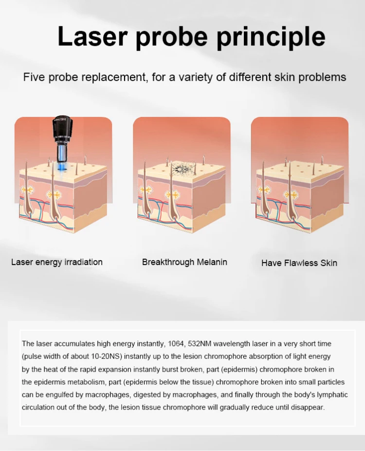 Pico Laser Tattoo Removal Machine