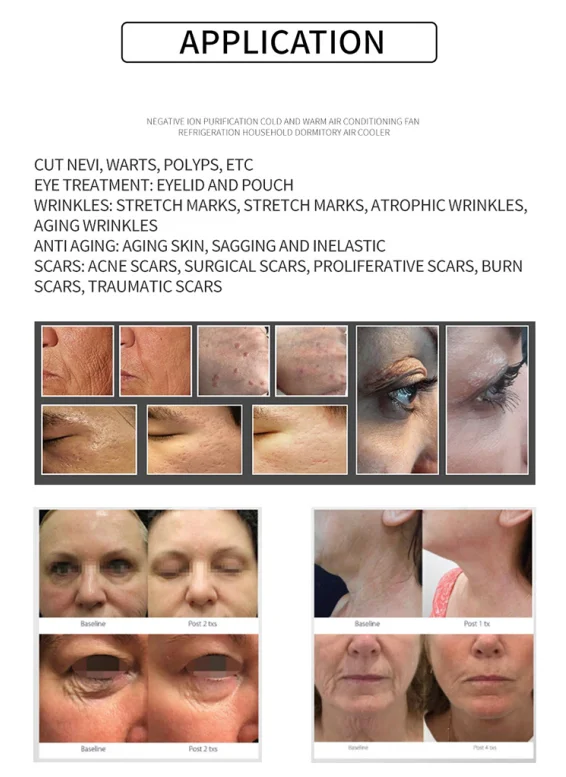 3 in 1 Plasma Pen Fractional Plasma Acne Removal Freckle Anti Wrinkle Face Lifting Anti Aging Machine