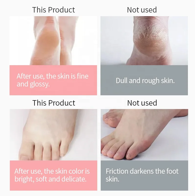 Feet Care Cream Private Label Custom Natural Urea Repair Healing Brightenning Moisturizing Whitening Foot Cream