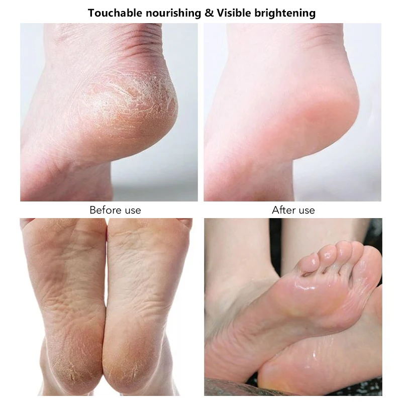 private label foot peal mask