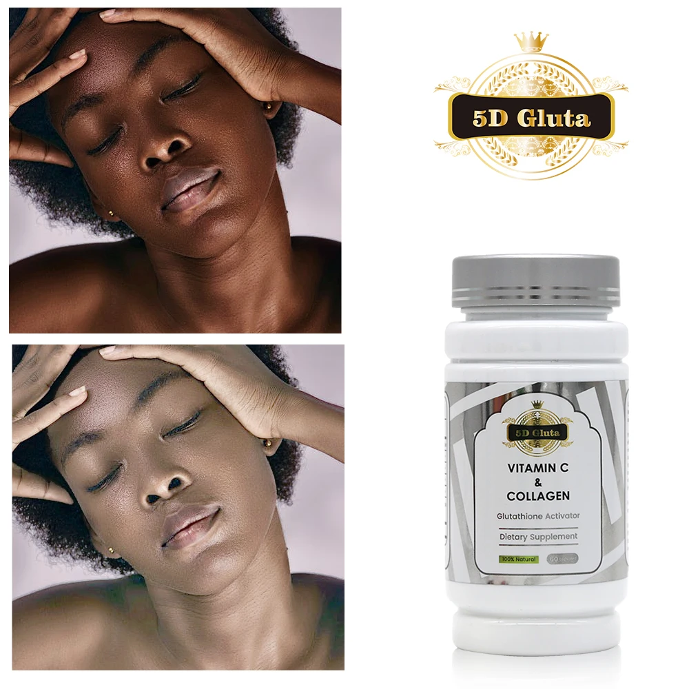 ccl advanced glutathione spray Diamond Nubian Whitening Pills Vitamin C