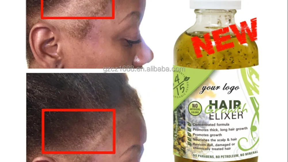 Best Hot Selling Natural Organic Formula Tea Tre Rosemary Hair Elixirs