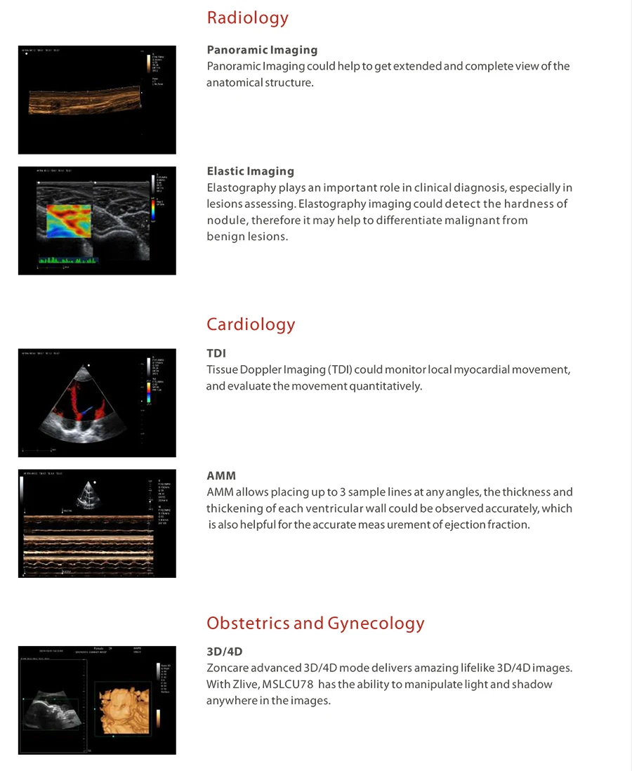 Medsinglong Linear Ultrasound Scanner Medical Ultrasound Instruments 4d ...