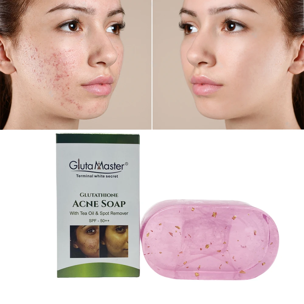 glutathione pimples Gluta Master Glutathione Acne Pimples Soap