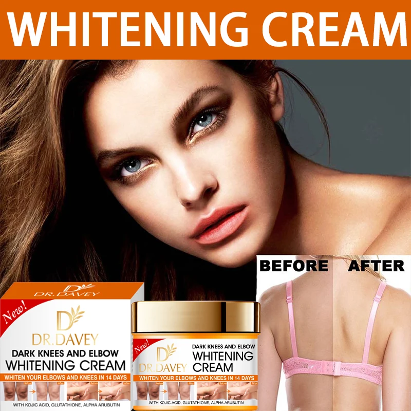 Dark Knees and Elbow Whitening Cream