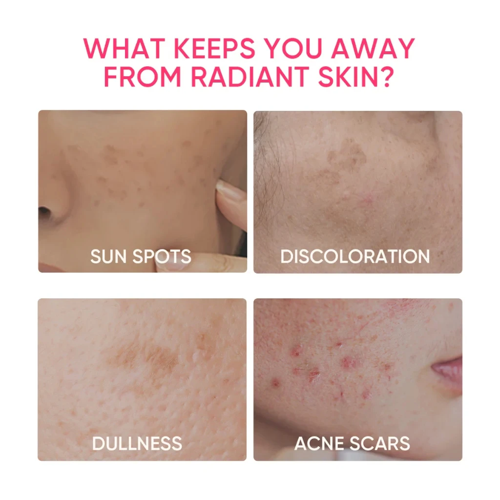 Custom Dark Spot Removing Reduce Redness Lightening MSH Niacinamide Brightening Glowing Moisture Gel Face Cream and Lotion