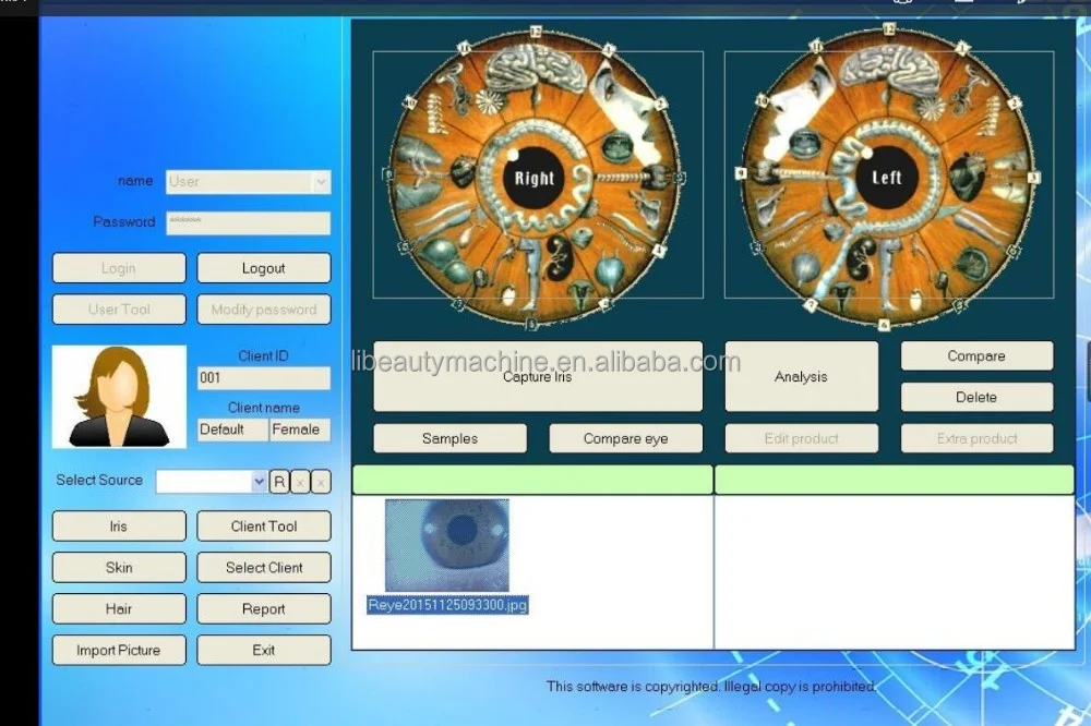 Eye Iridology9