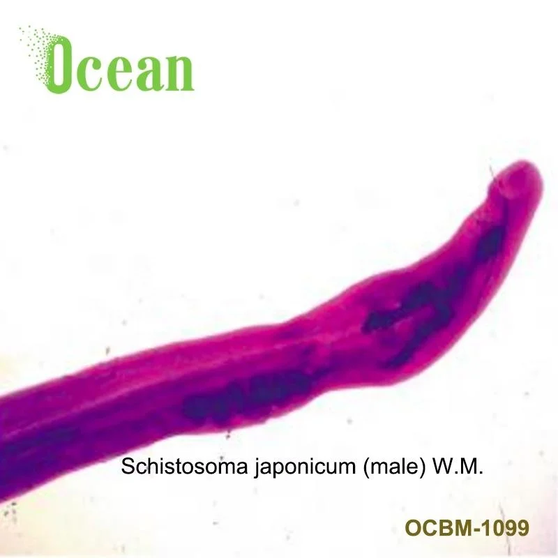 Schistosoma Slide