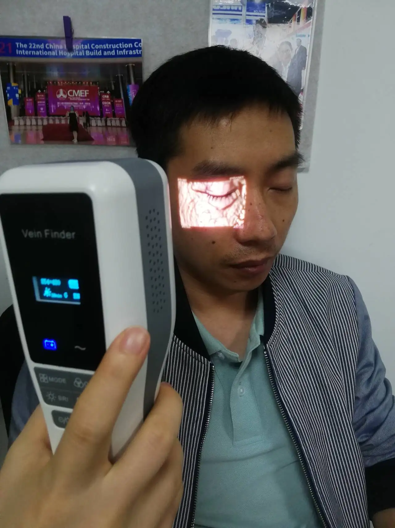 Vein Viewer Portable Sticker to Locate Vein Finder Lamp for Channeling Venous Veins