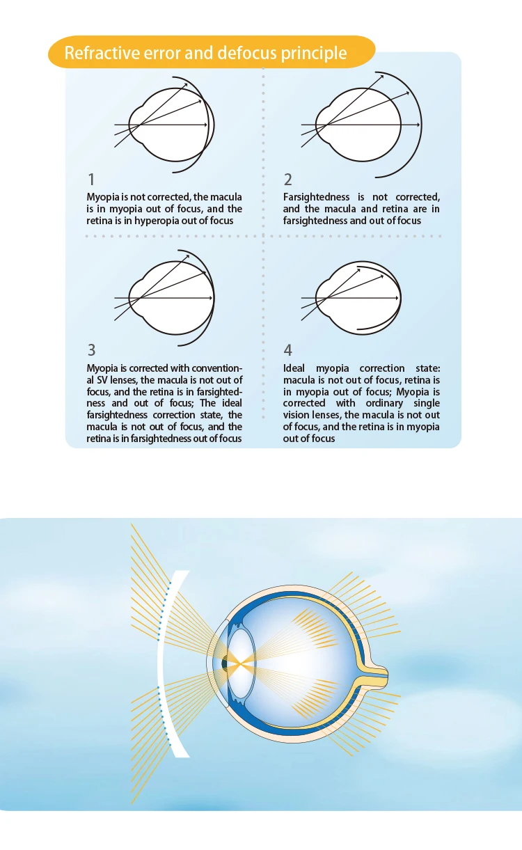 Optical Lens Polycarbonate Material Myopia Control Ophthalmic Lens