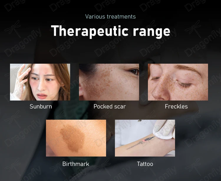 product-1-1 product-1-1