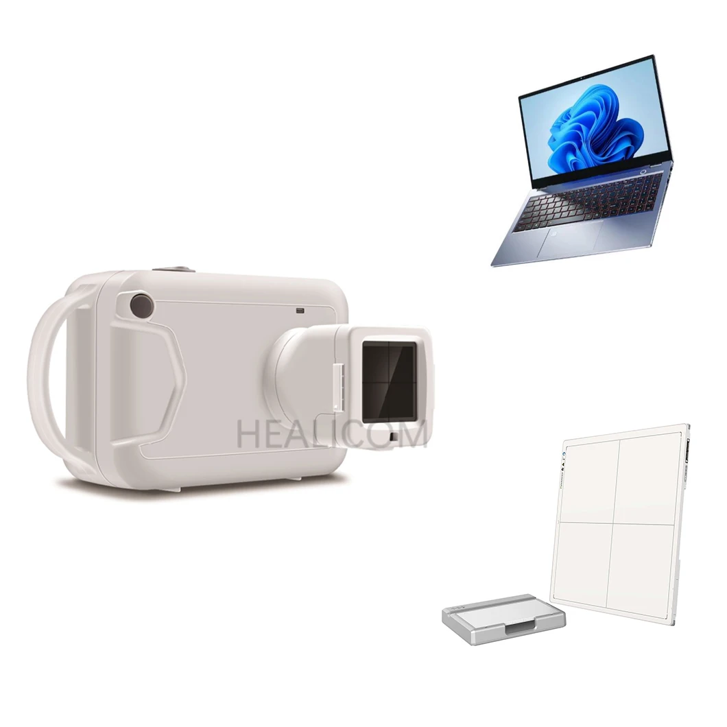 Hot Sale Radiology Equipment Minimize Radiation Portable X Ray Machine System