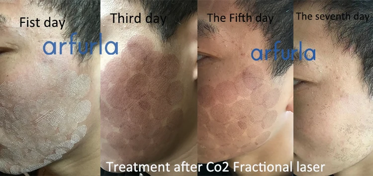 bEFORE AND AFTER CO2.jpg