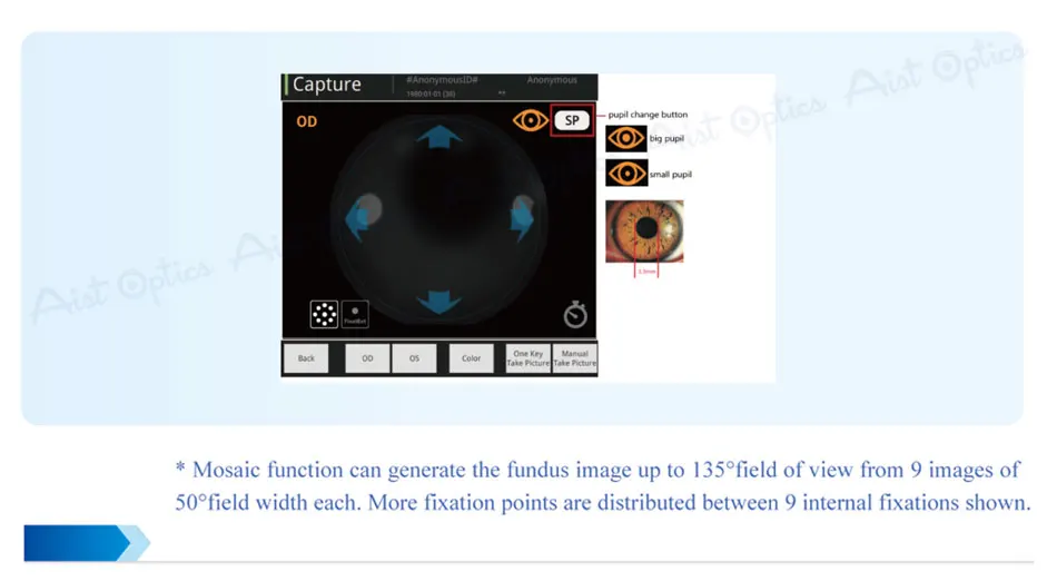 Reticam-3100 Ophthalmic Non-mydriatic Automatic Digital Retinal Fundus Camera