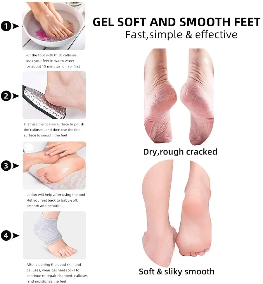 product factory hot sale foot file callus remover plastic stainless steel foot file-7