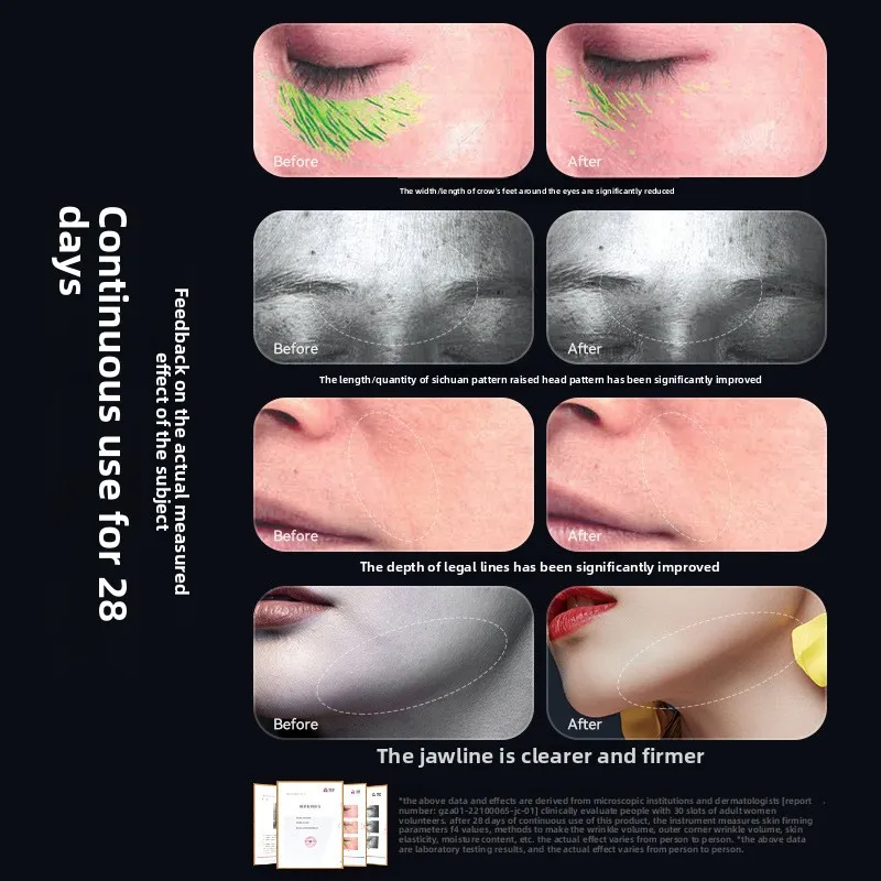 New EMS Cold Compress Tightening Massager 6-in-1 Multifunctional Face Lifting Household Beauty Equipment Colored Light 2025 Hot