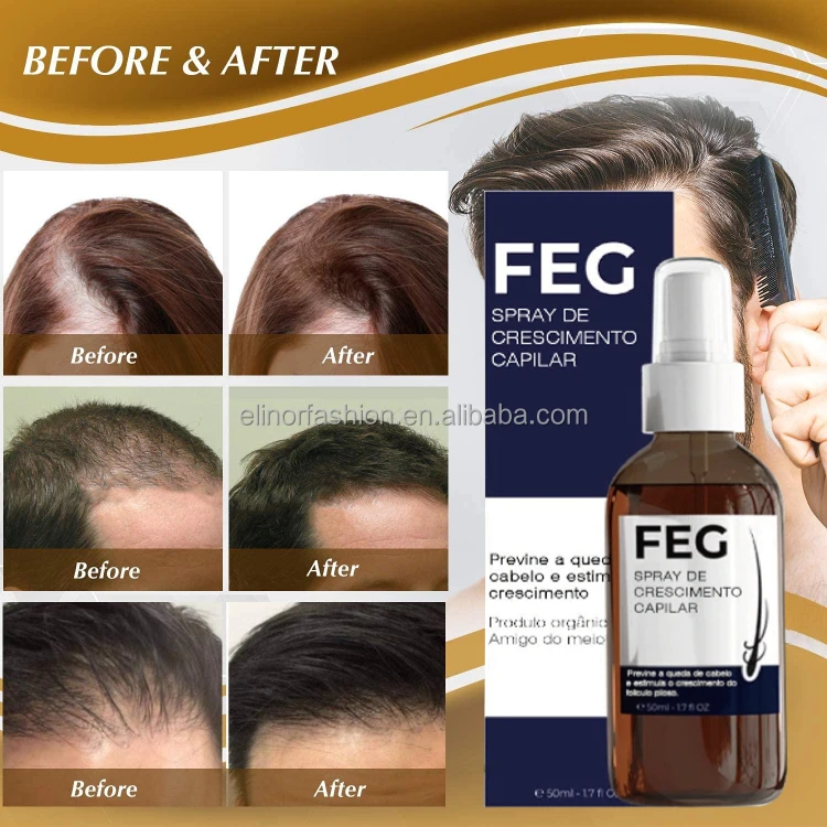 The Latest Inventions of China Ginseng Extract Polygonum YUDA Hair Growth Spray/ FEG Pilatory
